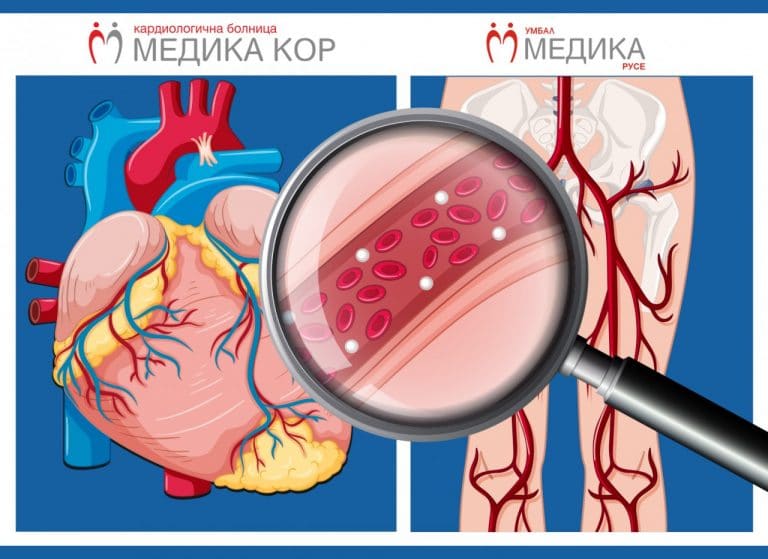 В “МЕДИКА” с безплатни прегледи при кардиолог и съдов хирург и през юли