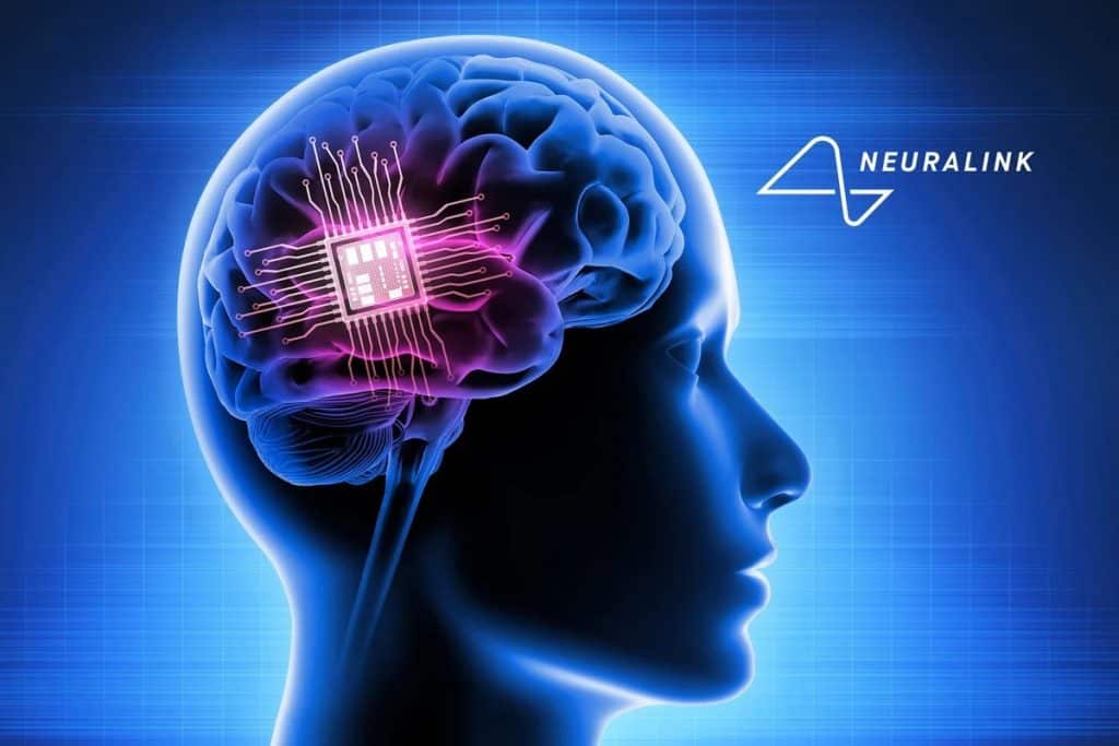 Neuralink на Мъск призна за проблеми с имплантирано в човек устройство